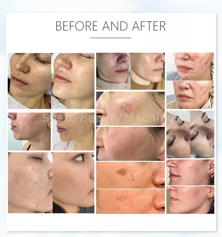 kf S6cc75fb2cdcc40418403f910f4bcadcfk