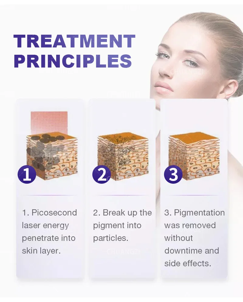 2 in 1 Diode Laser Hair Removal Machine Laser Picosecond 808 755 Alexander Stone Device 3 Wave IPL Permanent Hair Removal 17 kf Sa0460542f2d540fc8cf69a42c69d47c6s