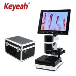 Nailfold Capillary Microcirculation Detector Blood vascular HD Capillary Microscope machine TV AV USB 7/8/9/10.1''LCD