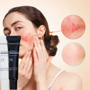 Facial Redness Repair Cream Improve Sensitive Skin Dryness Hydrating Sooth Lotion Removal Rosacea Day Night Korean Cosmetics